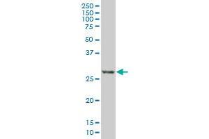 DSCR1 monoclonal antibody (M01A), clone 1G7. (RCAN1 antibody  (AA 1-100))