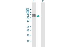 Western Blot analysis of ALPL expression in transfected 293T cell line by ALPL MaxPab polyclonal antibody. (ALPL antibody  (AA 1-524))