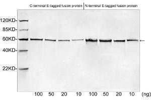 Western blot analysis of E tagged fusion proteins expressed in E. (E Tag antibody)