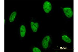 Immunofluorescence of monoclonal antibody to MPG on HeLa cell. (MPG antibody  (AA 1-90))
