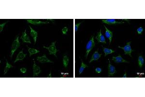 ICC/IF Image XIAP antibody [C1C3] detects XIAP protein at cytoplasm by immunofluorescent analysis. (XIAP antibody  (C-Term))