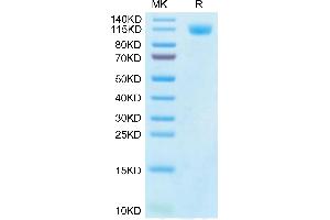 SARS-CoV-2 Spike S1 (Gamma P. (SARS-CoV-2 Spike S1 Protein (P.1 - gamma) (His tag))