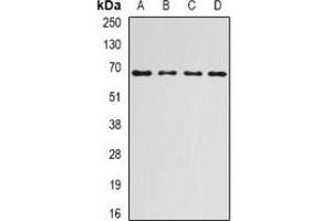 Western blot analysis of Ribophorin-1 expression in HepG2 (A), SKOV3 (B), mouse liver (C), rat liver (D) whole cell lysates. (RPN1 antibody)