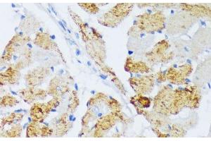 Immunohistochemistry of paraffin-embedded Rat heart using WSB2 Polyclonal Antibody at dilution of 1:100 (40x lens). (WSB2 antibody)