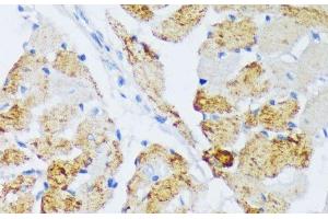 Immunohistochemistry of paraffin-embedded Rat heart using WSB2 Polyclonal Antibody at dilution of 1:100 (40x lens).