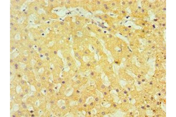TBRG1 antibody  (AA 22-150)