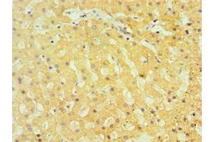 Immunohistochemistry of paraffin-embedded human liver tissue using ABIN7172813 at dilution of 1:100 (TBRG1 antibody  (AA 22-150))