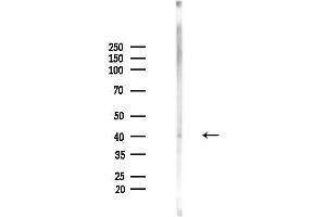 anti-Potassium Inwardly-Rectifying Channel, Subfamily J, Member 11 (KCNJ11) (pThr224) antibody