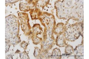 Immunoperoxidase of monoclonal antibody to IL15 on formalin-fixed paraffin-embedded human placenta. (IL-15 antibody  (AA 49-162))