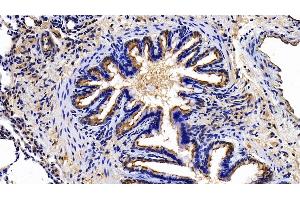 Detection of EPCR in Rat Lung Tissue using Polyclonal Antibody to Endothelial protein C receptor (EPCR) (PROCR antibody  (AA 59-217))