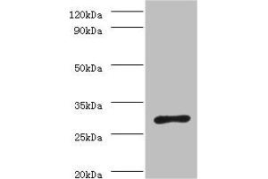 Western blot All lanes: ureA antibody at 2 μg/mL + Helicobacter pylori bacteria liquid Secondary Goat polyclonal to rabbit IgG at 1/10000 dilution Predicted band size: 27 kDa Observed band size: 27 kDa (Urea (AA 1-238) antibody)