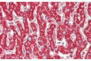Detection of AST2 in Human Liver Tissue using Polyclonal Antibody to Aspartate Aminotransferase 2 (AST2) (AST2 (AA 30-430) antibody)