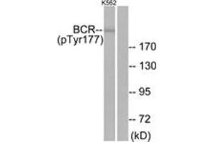 Western blot analysis of extracts from K562 cells, using Bcr (Phospho-Tyr177) Antibody. (BCR antibody  (pTyr177))