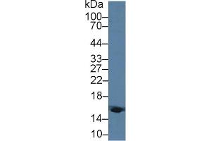 Detection of HBd in Human Blood Cells lysate using Polyclonal Antibody to Hemoglobin Delta (HBd) (HBd antibody  (AA 1-143))