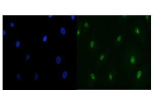 IF analysis of TIP49A/RUVBL1 using anti-TIP49A/RUVBL1 antibody (ABIN7599928).
