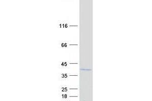 ZNF691 Protein (Myc-DYKDDDDK Tag)