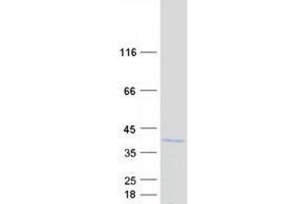 ZNF691 Protein (Myc-DYKDDDDK Tag)