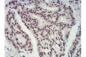 Immunohistochemistry (IHC) image for anti-Chromobox Homolog 4 (CBX4) (AA 397-514) antibody (ABIN5883842) (CBX4 antibody  (AA 397-514))