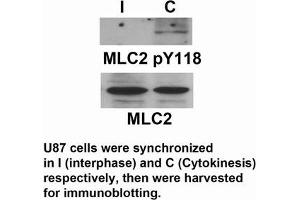 Western Blotting (WB) image for anti-Myosin Regulatory Light Chain 2, Smooth Muscle Isoform (MYL9) (pTyr118) antibody (ABIN7138917) (MYL9 antibody  (pTyr118))