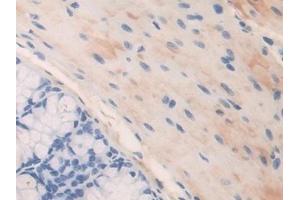 Detection of FBN1 in Mouse Colon Tissue using Polyclonal Antibody to Fibrillin 1 (FBN1) (Fibrillin 1 antibody  (AA 1703-1889))