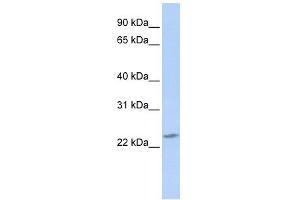 RBPMS2 antibody used at 1 ug/ml to detect target protein. (RBPMS2 antibody  (Middle Region))