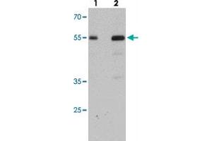 Western blot analysis of SDPR in HeLa cell lysate with SDPR polyclonal antibody  at (lane 1) 1 and (lane 2) 2 ug/mL.