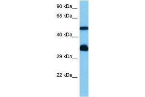 Host:  Mouse  Target Name:  HCLS1  Sample Tissue:  Mouse Heart  Antibody Dilution:  1ug/ml (HCLS1 antibody  (N-Term))