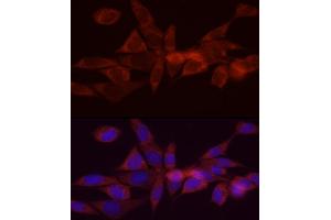 Immunofluorescence (IF) image for anti-Diacylglycerol O-Acyltransferase 1 (DGAT1) (AA 200-300) antibody (ABIN6139556)