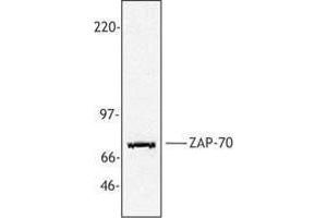 Western Blotting (WB) image for anti-zeta-Chain (TCR) Associated Protein Kinase 70kDa (ZAP70) antibody (ABIN2665463) (ZAP70 antibody)