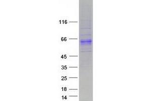 Western Blotting (WB) image for Acid Phosphatase-Like 2 (ACPL2) (Transcript Variant 2) protein (Myc-DYKDDDDK Tag) (ABIN2714320)