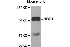 Western Blotting (WB) image for anti-Nucleotide-Binding Oligomerization Domain Containing 1 (NOD1) (AA 1-270) antibody (ABIN3021838) (NOD1 antibody  (AA 1-270))