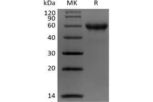Western Blotting (WB) image for Carbonic Anhydrase IX (CA9) protein (His tag,Biotin) (ABIN7319776) (CA9 Protein (His tag,Biotin))
