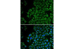 Immunofluorescence analysis of U2OS cells using TYR antibody (ABIN5970593). (TYR antibody)