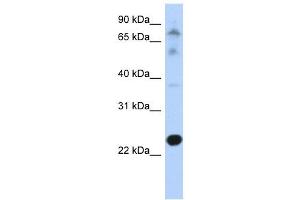 CHIC2 antibody used at 1 ug/ml to detect target protein.