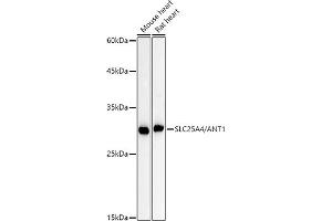 Western blot analysis of extracts of various cell lines, using SLC25/ antibody (ABIN7270428) at 1:1000 dilution.