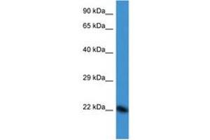 Image no. 1 for anti-Double Homeobox 3 (DUX3) (N-Term) antibody (ABIN6747565)