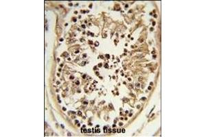 Formalin-fixed and paraffin-embedded human testis tissue reacted with CHPF Antibody (Center), which was peroxidase-conjugated to the secondary antibody, followed by DAB staining. (CHPF antibody  (AA 327-354))
