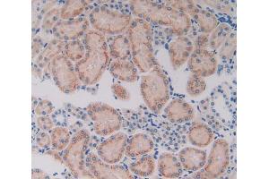 Used in DAB staining on fromalin fixed paraffin- embedded kidney tissue (CYP7A1 antibody  (AA 109-383))