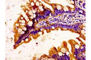 C1QTNF3 antibody  (AA 23-246)