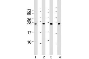 Western blot testing of human 1) HeLa, 2) HepG2, 3) Jurkat and 4) mouse NIH3T3 cell lysate with RAB5B antibody at 1:2000.
