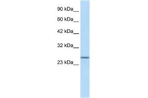 WB Suggested Anti-SOX14 Antibody Titration:  1. (SOX14 antibody  (N-Term))