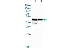 Western blot analysis of Lane 1: Human cell line RT-4 Lane 2: Human cell line U-251MG with RCN3 polyclonal antibody  at 1:500-1:1000 dilution. (RCN3 antibody)