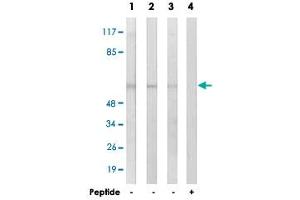 Western blot analysis of extracts from COLO cells (Lane 1), HUVEC cells (Lane 2 and lane 4) and MCF-7 cells (Lane 3), using GRB14 polyclonal antibody .