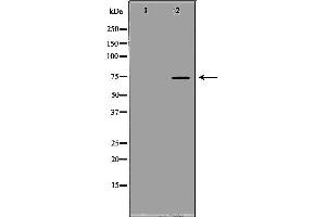 Western blot analysis of extracts of PC-3, using SCNN1B antibody. (SCNN1B antibody  (C-Term))