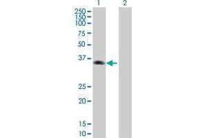 Western Blot analysis of ZNF187 expression in transfected 293T cell line by ZNF187 MaxPab polyclonal antibody. (ZNF187 antibody  (AA 1-325))