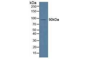 Detection of MPG1 in Human Serum using Polyclonal Antibody to Macrophage Expressed Gene 1 Protein (MPG1) (MPEG1 antibody  (AA 313-580))