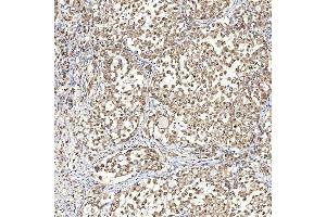 IHC analysis of Syntenin 2/SDCBP2 using anti-Syntenin 2/SDCBP2 antibody (ABIN7600017). (SDCBP2 antibody  (AA 14-292))
