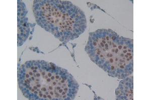 Used in DAB staining on fromalin fixed paraffin- embedded testis tissue (RNASEH2A antibody  (AA 1-301))
