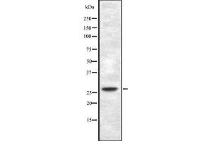 Western blot analysis of TP53INP1 using HepG2 whole cell lysates (TP53INP1 antibody  (Internal Region))