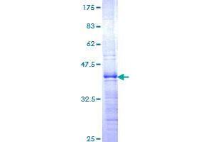 ZHX1 Protein (AA 731-829) (GST tag)